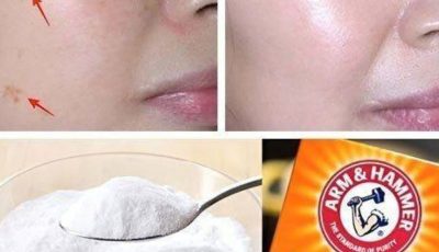 4 Ways to Erase Age Spots with Baking Soda? Proceed with Caution — Here’s What You Need to Know