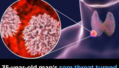 ⚠️ 35-Year-Old Man’s Sore Throat Turned into Cancer — Doctor Urges: Remove These 2 Items From Your Fridge Now 🚨🫙
