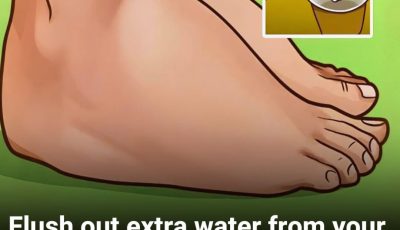 Say Goodbye to Swelling: Natural Ways to Beat Water Retention Fast