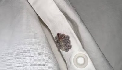 Those Tiny Balls in Your Bed? Here’s What They Really Are (And Why It’s Probably NOT Stink Bug Eggs)