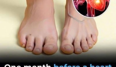 One Month Before a Heart Attack: 7 Subtle Warning Signs Your Body May Send (And What to Do)