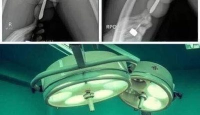 Girl had to be hospitalized for wanting to use a pe