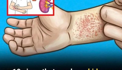 10 Ways Your Body Warns You About Kidney Disease (But You Don’t Notice)