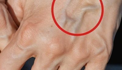 If you have visible veins, it means you are…