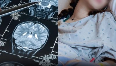 5 Alarming Stroke Warning Signs to Watch for in Young People