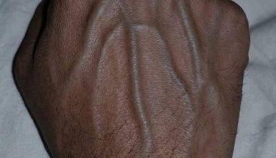 If you have visible veins, it means you are….