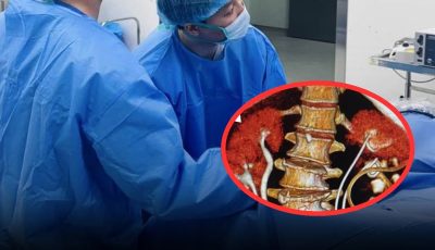 Woman, 58, Suffers Kid.ney Full of Pus and Severe Kid